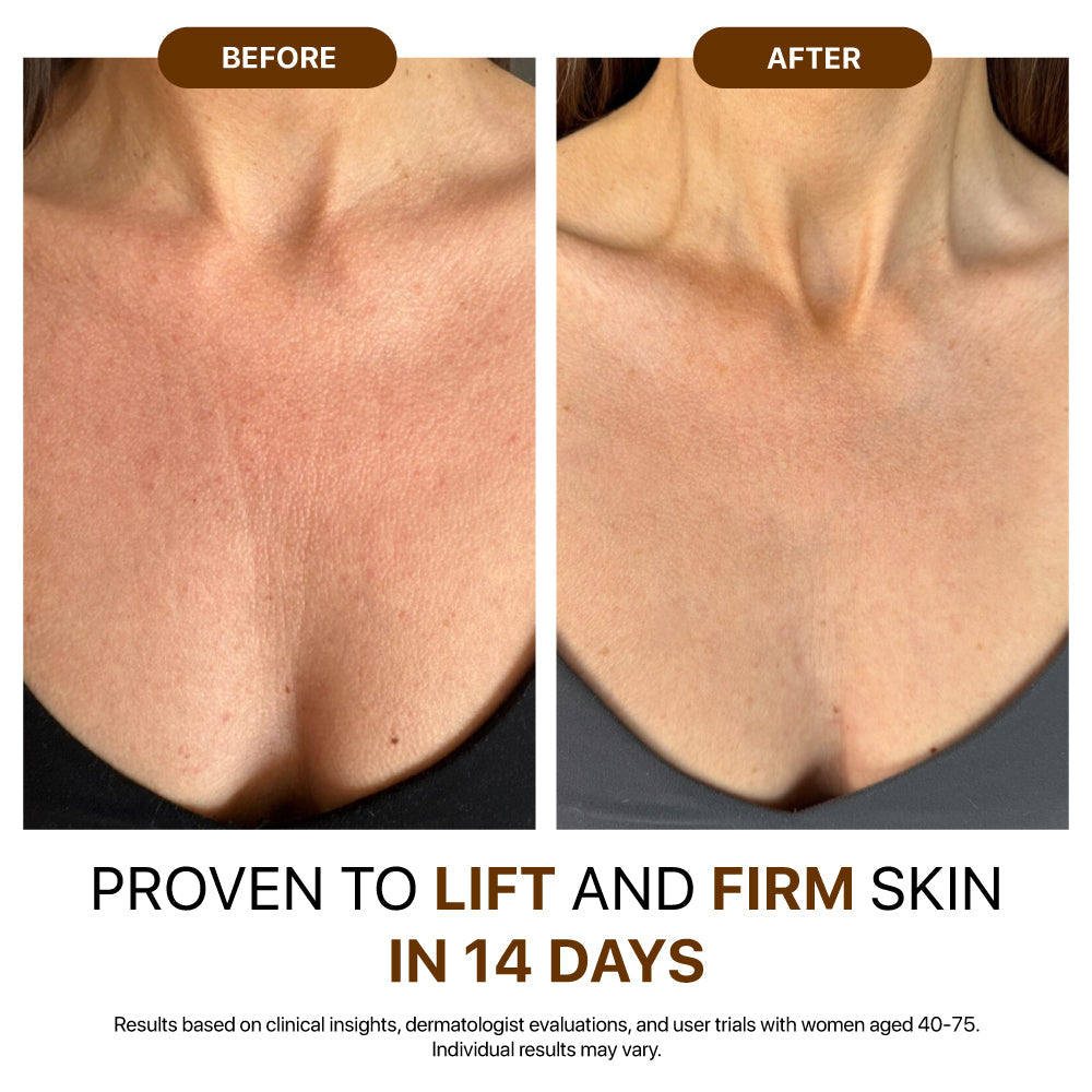 Rediscover confidence with firmer, smoother, radiant skin